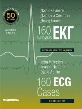 160 випадків ЕКГ: 6-е видання. Джон Хемптон, Джоанна Хемптон, Девід Едлем (дві мови) 160 випадків ЕКГ: 6-е видання. Джон Хемптон, Джоанна Хемптон, Девід Едлем (дві мови)