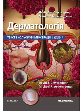 Дерматологія: текст і кольорові ілюстрації: 7-е видання. Девід Дж. Гоукроджер, Майкл Р. Ардерн-Джонс Дерматологія: текст і кольорові ілюстрації: 7-е видання. Девід Дж. Гоукроджер, Майкл Р. Ардерн-Джонс