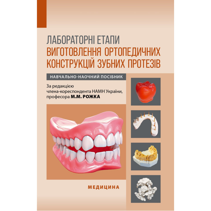 Лабораторні етапи виготовлення ортопедичних конструкцій зубних протезів