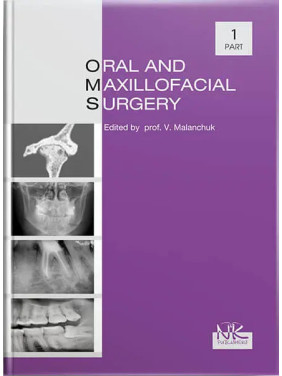 Oral and Maxillofacial Surgery. Частина 1. 2-ге вид. Маланчук В. О. Oral and Maxillofacial Surgery. Частина 1. 2-ге вид. Маланчук В. О.