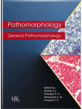 Pathomorphology. General Pathomorphology. Боднар Я. Я., Багрій М. М., Боднар Л. П. та ін. Pathomorphology. General Pathomorphology. Боднар Я. Я., Багрій М. М., Боднар Л. П. та ін.