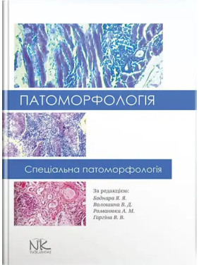 Патоморфологія. Спеціальна патоморфологія. Боднар Я. Я., Волошина В. Д., Романюк А. М., Гаргіна В. В. (за ред.) Патоморфологія. Спеціальна патоморфологія. Боднар Я. Я., Волошина В. Д., Романюк А. М., Гаргіна В. В. (за ред.)