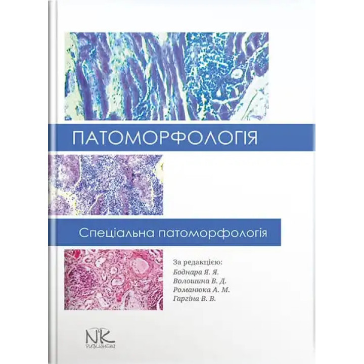 Патоморфологія. Спеціальна патоморфологія. Боднар Я. Я., Волошина В. Д., Романюк А. М., Гаргіна В. В. (за ред.)