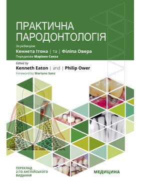 Практична пародонтологія. 2-е видання. Кеннет Ітон, Філіп Овер Практична пародонтологія. 2-е видання. Кеннет Ітон, Філіп Овер