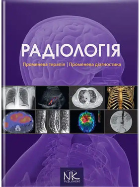 Радіологія. Променева терапія. Променева діагностика. 2-ге видання. Ковальський О. В. та ін. Радіологія. Променева терапія. Променева діагностика. 2-ге видання. Ковальський О. В. та ін.