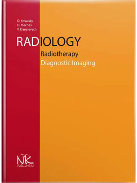 Radiology. Radiotherapy. Diagnostic Imaging/Радіологія. Променева терапія. Променева діагностика. 2-ге вид. Ковальський О. В .та ін. Radiology. Radiotherapy. Diagnostic Imaging/Радіологія. Променева терапія. Променева діагностика. 2-ге вид. Ковальський О. В .та ін.